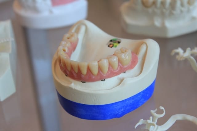 all-on-six dental implants